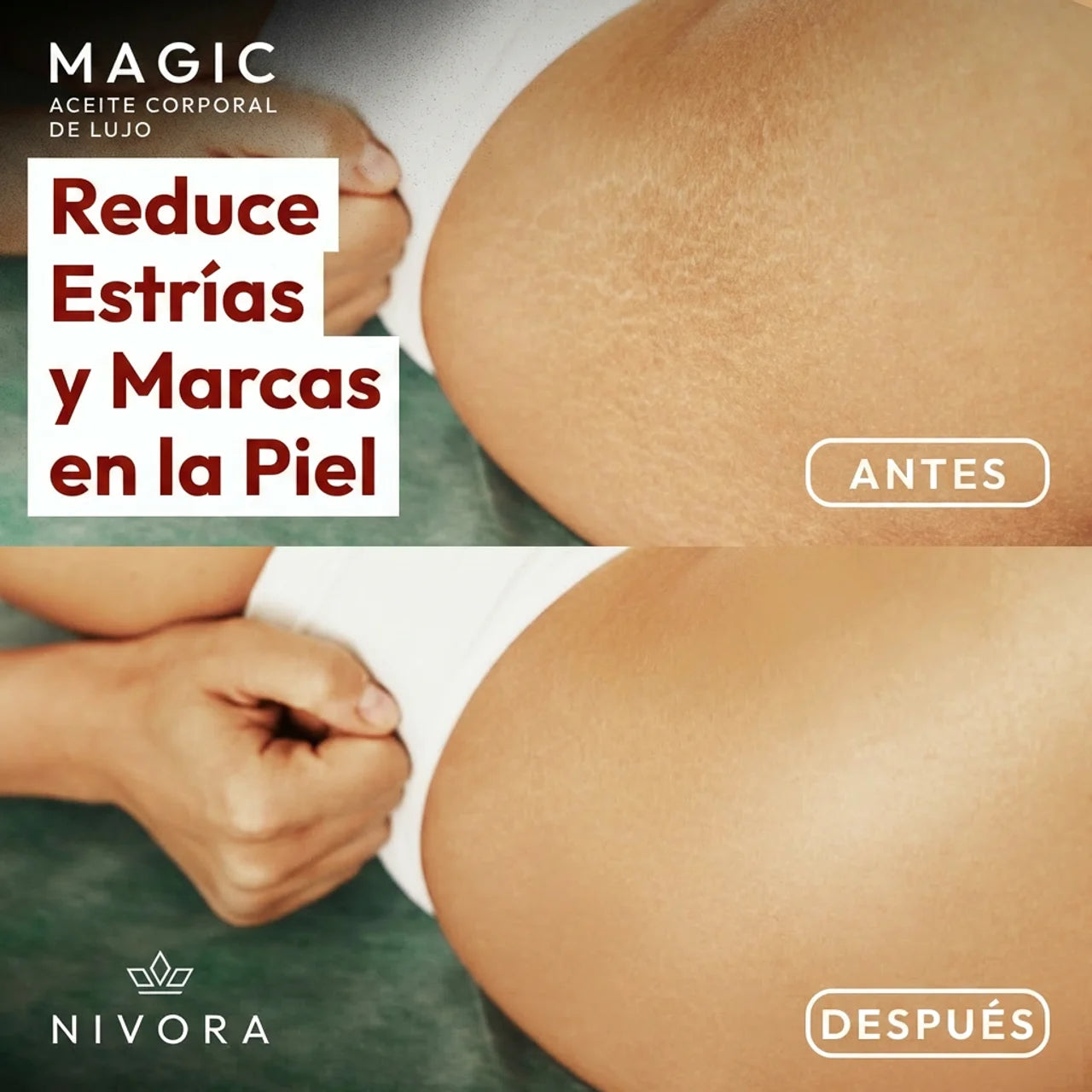 Nivora™ Aceite Corporal Magic – 100 ml